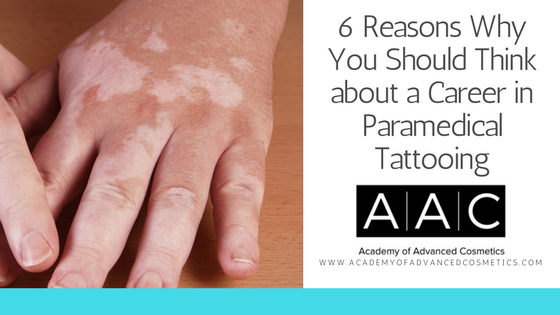 6 reasons why you should think about a career in paramedical tattooing